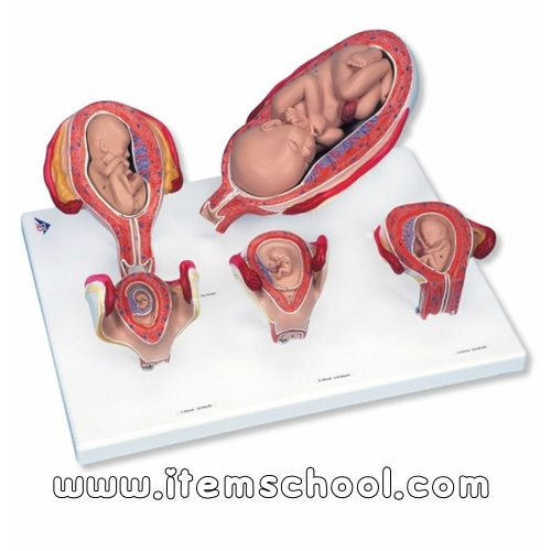 임신모형 시리즈, 5 가지 모형